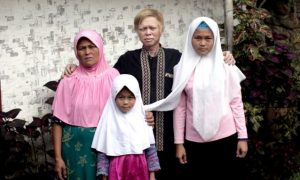 Melihat Kehidupan Kampung Albino atau Sunda Walanda di Garut
