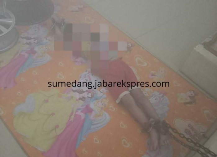 Kondisi Bocah 5 Tahun di Sumedang yang mengalami kekerasan dalam kedaan mengenaskan