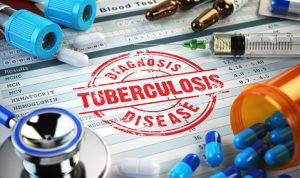 Ilustrasi kasus TBC yang meningkat pesat di Cianjur