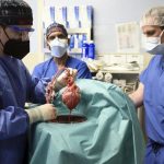 transplantasi organ hewan