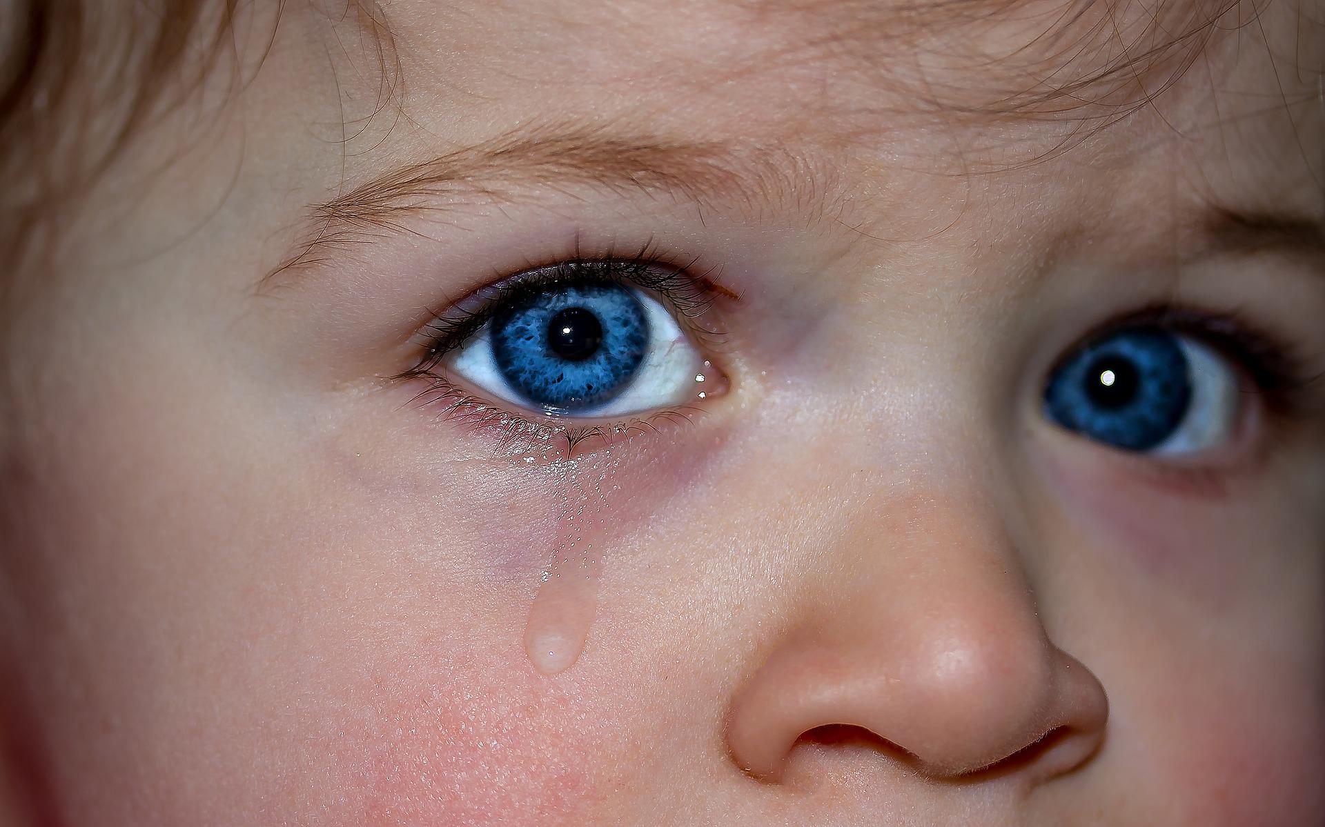Ilustrasi: aquagenic urticaria, alergi ini bisa membuat gatal-gatal saat menangis. (Pixabay)
