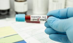 Dari 14 Kasus, Hepatitis Misterius Paling Banyak Menyerang Usia Balita