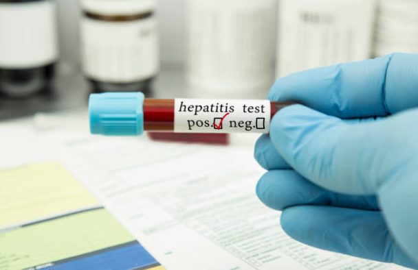 Dari 14 Kasus, Hepatitis Misterius Paling Banyak Menyerang Usia Balita