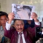 Hasil Autopsi Ulang Jenazah Brigadir J, Kamaruddin: Ada Tembakan dari Kepala Belakang hingga Tembus ke Bagian Hidung
