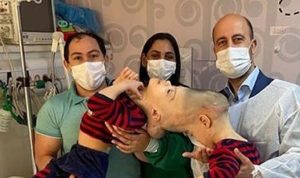 Bocah Kembar Siam Dempet Kepala Berhasil Dipisahkan dengan Operasi Virtual