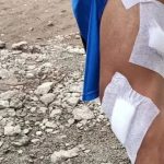 Kondisi kaki korban yang mengalami luka-luka. Kini terungkap motif istri yang nyaris potong burung di bekasi tersebut. Foto: Instagram.com/polsek_cikarangutara