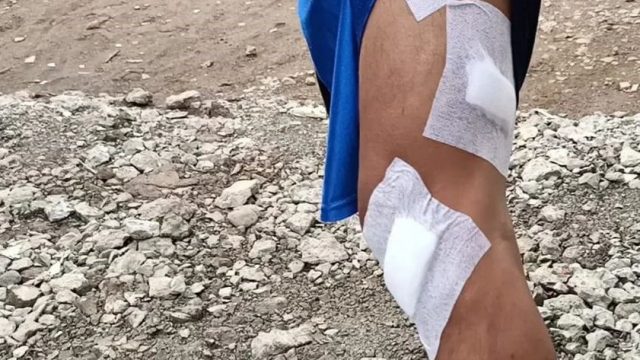 Kondisi kaki korban yang mengalami luka-luka. Kini terungkap motif istri yang nyaris potong burung di bekasi tersebut. Foto: Instagram.com/polsek_cikarangutara