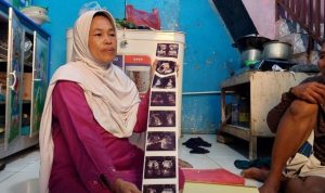 Anak di Bekasi Gagal Ginjal Akut Diduga Karena Vaksin Covid-19