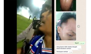 Aremania Sempat Minta Polisi Jangan Tembak Gas Air Mata: Ada Anak Kecil Pak!
