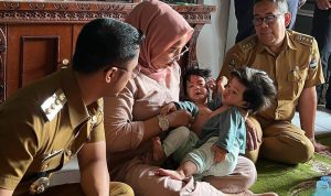 Bayi Kembar Siam, Bayi Kembar Siam, Bayi, Kembar Siang, Kabupaten Bandung Barat, Bupati Bandung Barat, Henky Kurniawan