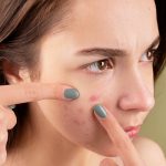 Hindari! Kandungan Skincare yang Tidak Cocok untuk Kulit Berjerawat