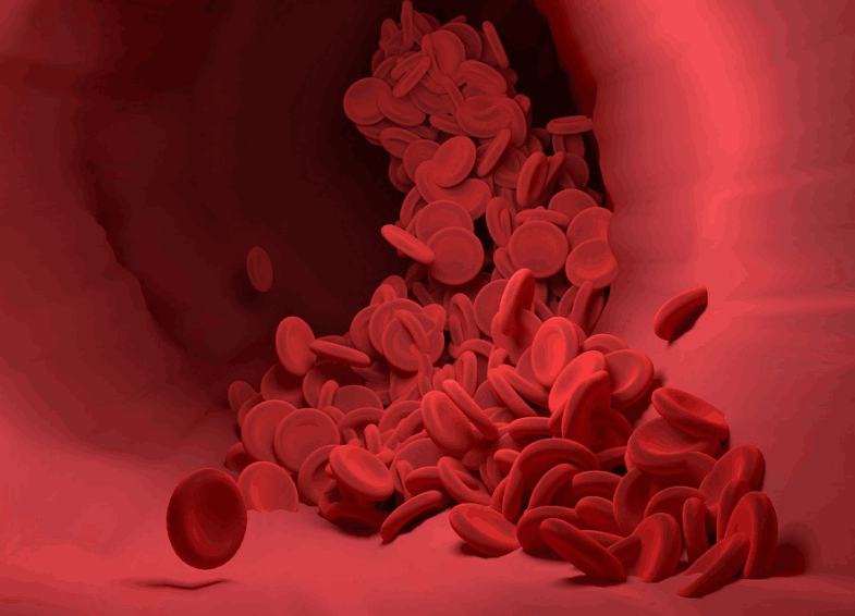 Penyebab Pembekuan Darah/Foto: Pixabay