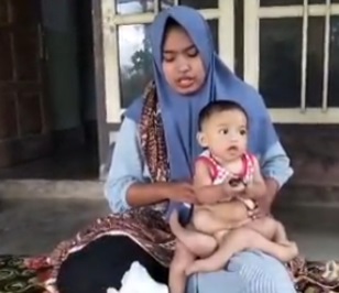 Tangnkapan layar Youtube tentang kondisi terkini bayi berkaki enam di lombok. (youtube)