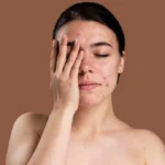 Viral! Wanita Mengalami Perubahan Kulit Wajah akibat Skincare yang Mengandung Merkuri