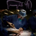 Revitalisasi Cangkok Organ Ginjal Babi Ke Manusia