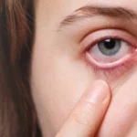 7 Kebiasaan Sepele yang Bisa Merusak Mata, Apa Saja?