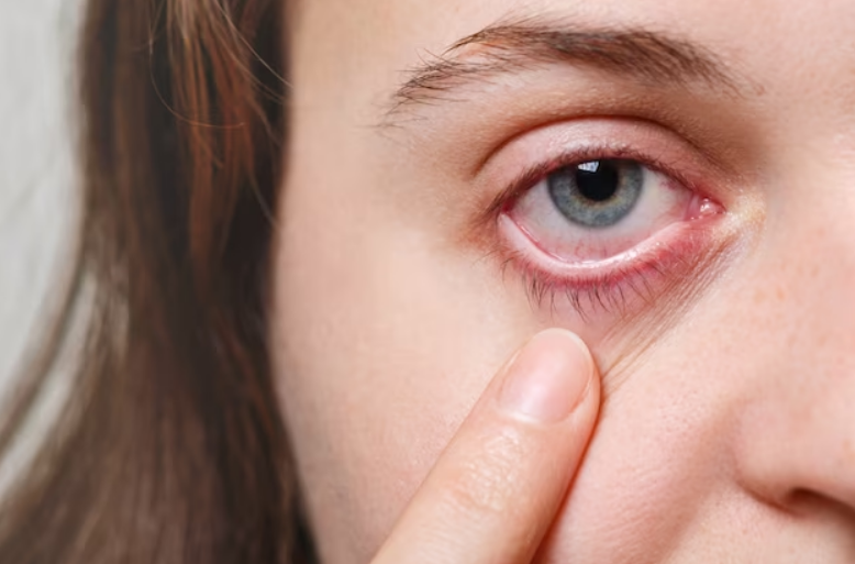 7 Kebiasaan Sepele yang Bisa Merusak Mata, Apa Saja?