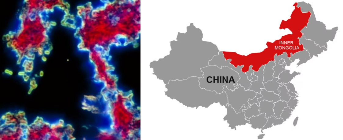 Dua Kasus Terinfeksi Penyakit Pes di China Langsung di Karantina