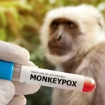 ILUSTRASI: Kasus cacar monyet atau Monkeypox (MPox) ang kini trus bertambah. (freepik)