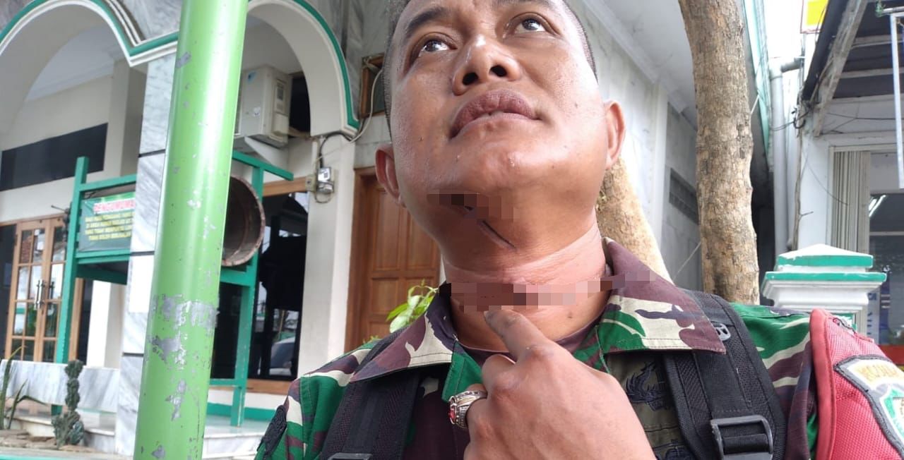 Leher Anggota TNI di Ciamis Ini Terluka Akibat Tersangkut Kabel Diduga Milik Telkom