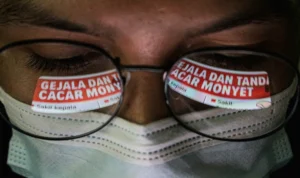 Sembuhnya Pasien Cacar Monyet di Kota Bandung, Kadinkes: Sudah Dinyatakan Sehat