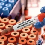 Pneumonia Mulai Masuk di Indonesia, Kemenkes Siapkan Jaringan Laboratorium
