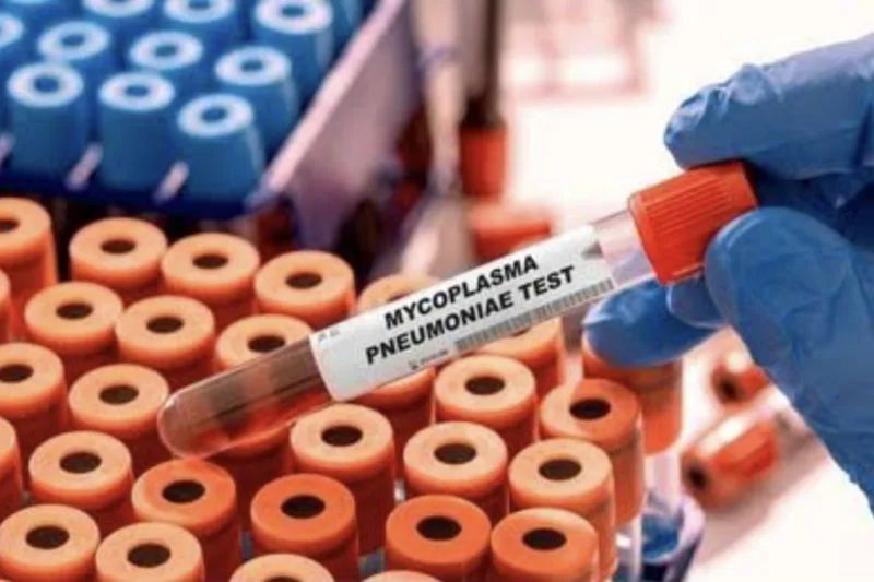 Pneumonia Mulai Masuk di Indonesia, Kemenkes Siapkan Jaringan Laboratorium