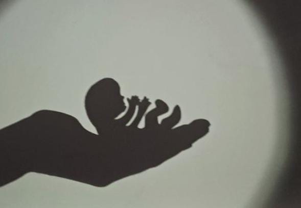 Ilustrasi: Aborsi (Yudha Prananda / Jabar Ekspres)
