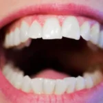 Hindari 3 Kebiasaan Sepele yang Bikin Gigi Berantakan Sejak Kecil