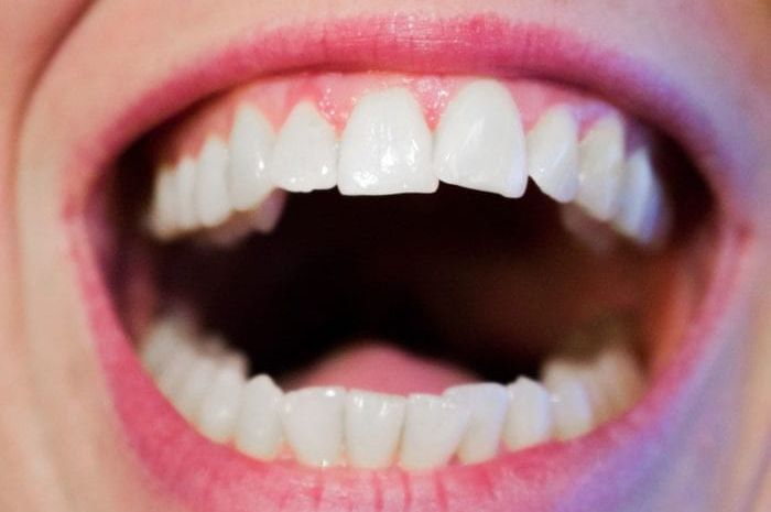 Hindari 3 Kebiasaan Sepele yang Bikin Gigi Berantakan Sejak Kecil