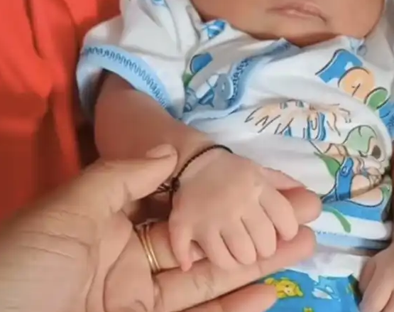 Viral! Seorang Bayi Lahir dengan 6 Jari di Kedua Tangan dan Kakinya