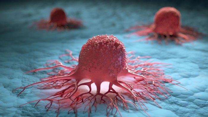 Penelitian Ungkap Gen X dan Milenial Rentan Kanker, Ini Alasannya