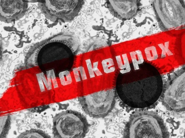 Ilustrasi waspada cacar monyet atau Monkeypox. Dok (pixabay)