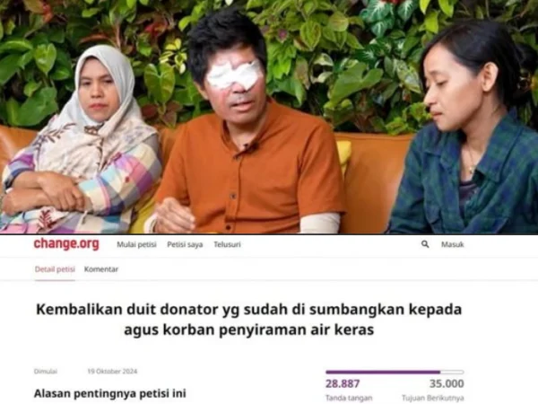 Petisi Pengembalian Uang Donasi untuk Agus Korban Penyiraman Air Keras Ramai Dicari Netizen, Begini Kronologinya