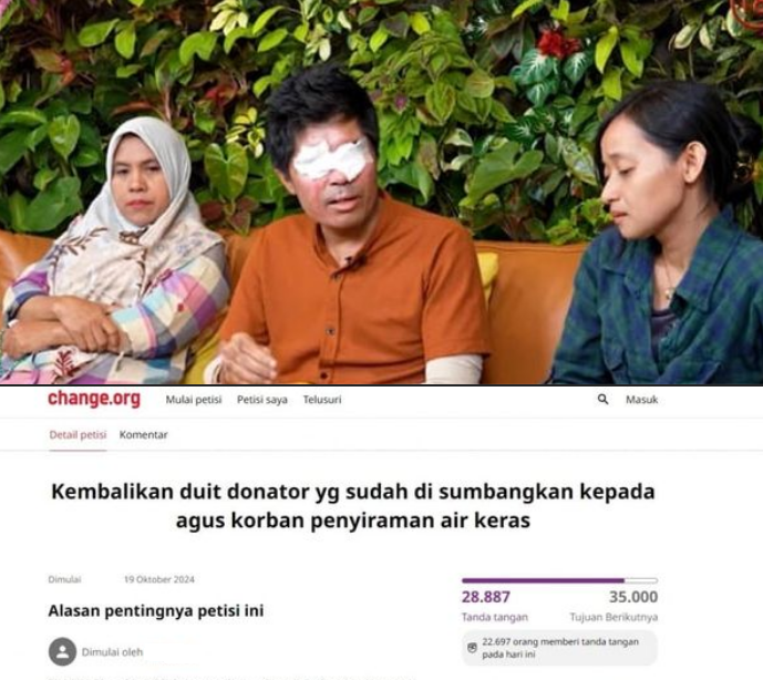 Petisi Pengembalian Uang Donasi untuk Agus Korban Penyiraman Air Keras Ramai Dicari Netizen, Begini Kronologinya