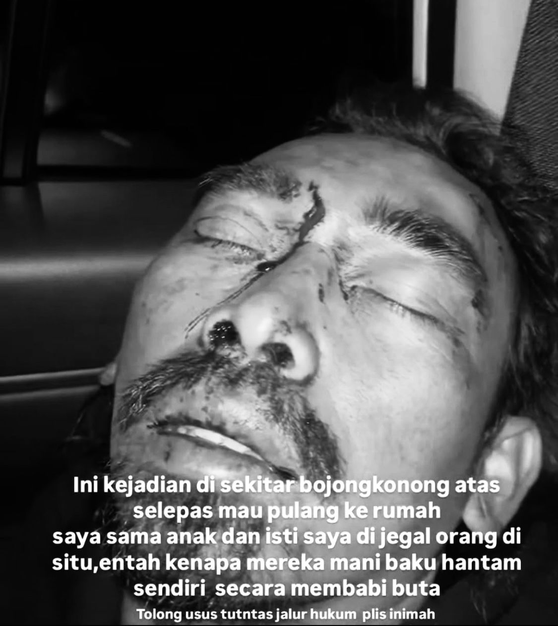 Pegiat motor trail dan pengusaha kopi yakni Ferly Renaldi (39) atau lebih dikenal Dudung SP menjadi korban pengeroyokan yang dilakukan oleh orang tidak dikenal (OTK) di wilayah Cimenyan, Kabupaten Bandung pada Rabu (1/1/2025) malam. Dok Instagram erwinmoron_official