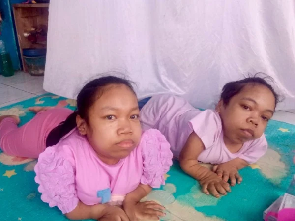 Gina dan Siti, dua penyandang disabilitas asal Desa Bongas, Kecamatan Cililin menanti bantuan dari Pemda Bandung Barat. Selasa (7/1). Dok Jabar Ekspres/wit