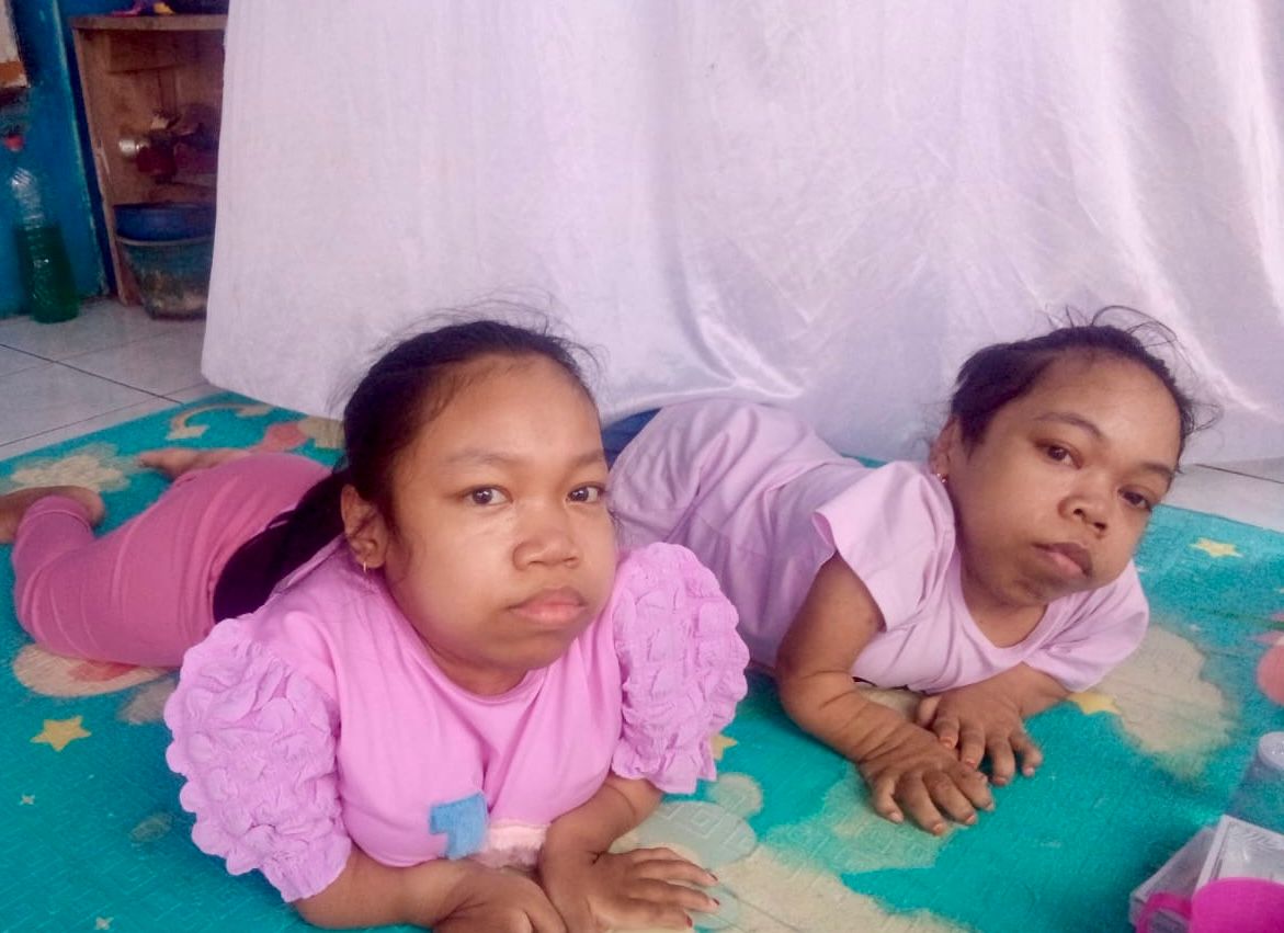 Gina dan Siti, dua penyandang disabilitas asal Desa Bongas, Kecamatan Cililin menanti bantuan dari Pemda Bandung Barat. Selasa (7/1). Dok Jabar Ekspres/wit